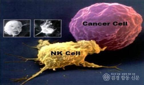 암NK.jpg