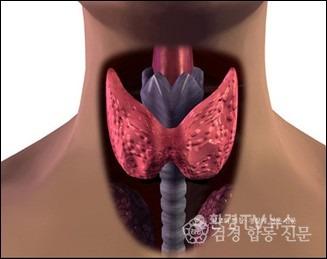 갑상선.jpg