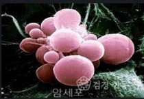 암세포.jpg