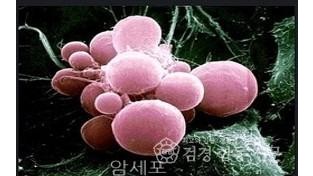 암세포.jpg