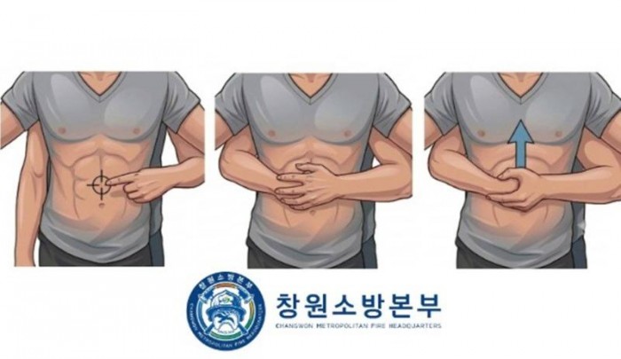 260610-2기도폐쇄 응급처치 요령 홍보.jpg